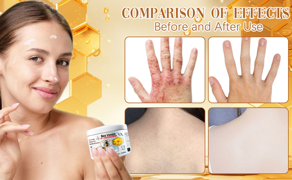 Bee Venom Skin MULTI-SYMPTOM TREATMENT CREAM