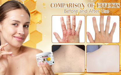 Bee Venom Skin MULTI-SYMPTOM TREATMENT CREAM