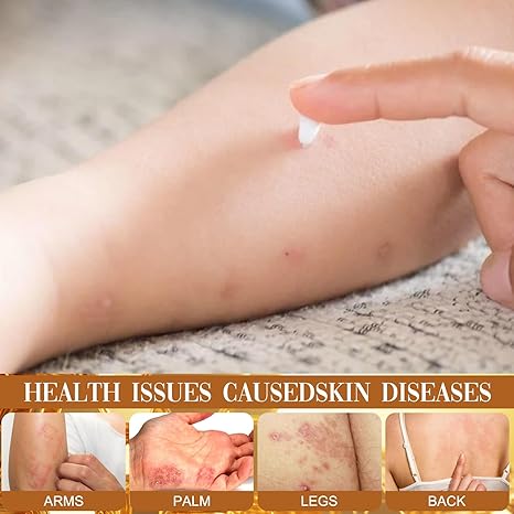 Bee Venom Skin MULTI-SYMPTOM TREATMENT CREAM