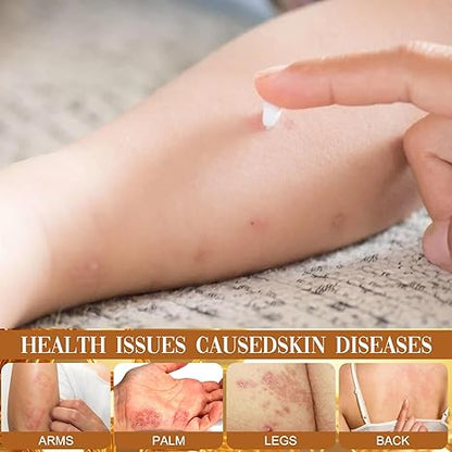 Bee Venom Skin MULTI-SYMPTOM TREATMENT CREAM