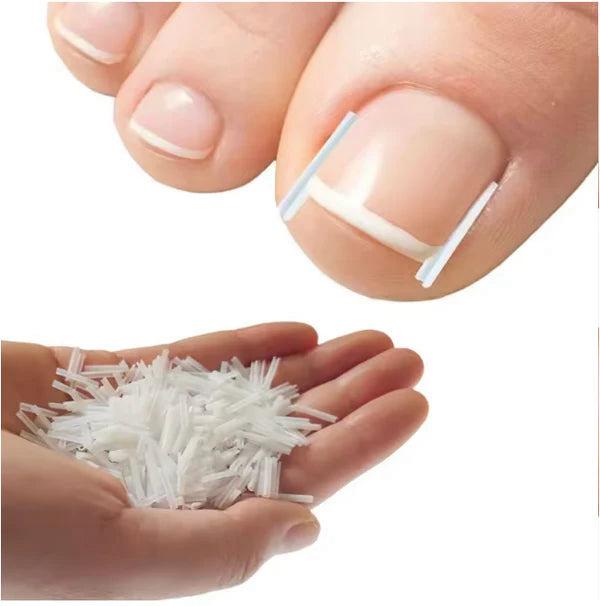 Toenail Correction Strips